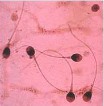 spermatozoa