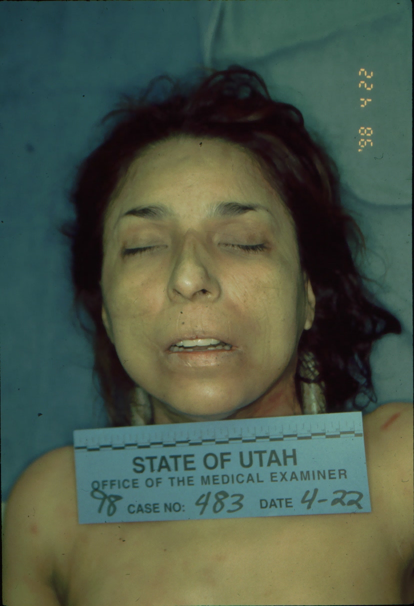 Utah Investigators Ask For Help Identifying Victim In 20 Year Old Cold Case St George News
